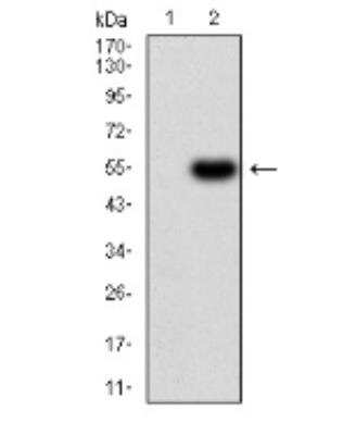 Western Blot: Serpin A1/alpha 1-Antitrypsin Antibody (5D1D2)BSA Free [NBP2-52557]