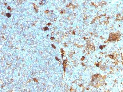 Immunohistochemistry-Paraffin: Serpin A1/alpha 1-Antitrypsin Antibody (AAT/1378) - Azide and BSA Free [NBP3-11618]