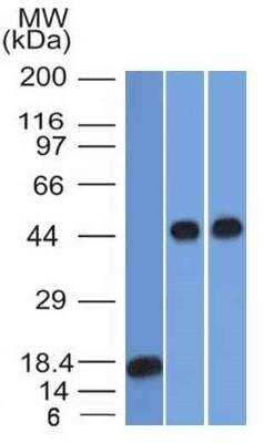 Western Blot: Serpin A1/alpha 1-Antitrypsin Antibody (AAT/1378)Azide and BSA Free [NBP3-11618]