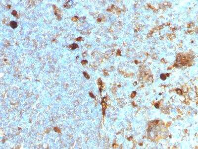 Immunohistochemistry-Paraffin: Serpin A1/alpha 1-Antitrypsin Antibody (AAT/1378) [NBP2-48476]