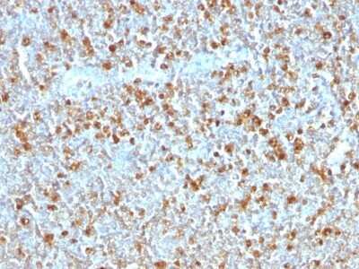 Immunohistochemistry-Paraffin: Serpin A1/alpha 1-Antitrypsin Antibody (AAT/1379) [NBP2-53302]