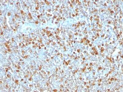 Immunohistochemistry-Paraffin: Serpin A1/alpha 1-Antitrypsin Antibody (AAT/1379) - Azide and BSA Free [NBP2-54442]