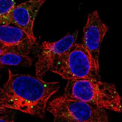 Immunocytochemistry/ Immunofluorescence: Serpin A1/alpha 1-Antitrypsin Antibody [NBP1-90309]