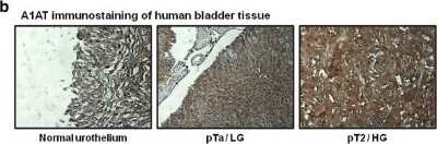 Immunohistochemistry: Serpin A1/alpha 1-Antitrypsin Antibody [NBP1-90309]