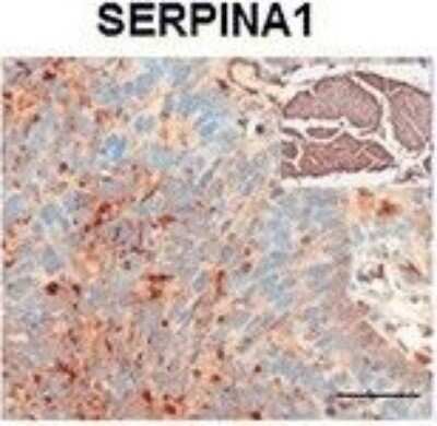 Immunohistochemistry: Serpin A1/alpha 1-Antitrypsin Antibody [NBP1-90309]