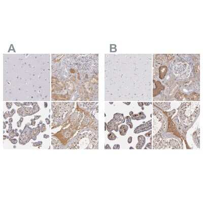 Immunohistochemistry-Paraffin: Serpin A1/alpha 1-Antitrypsin Antibody [NBP1-90308]