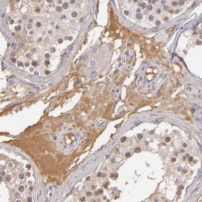 Immunohistochemistry-Paraffin: Serpin A1/alpha 1-Antitrypsin Antibody [NBP1-90308]