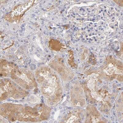 Immunohistochemistry-Paraffin: Serpin A1/alpha 1-Antitrypsin Antibody [NBP1-90308]