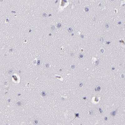 Immunohistochemistry-Paraffin: Serpin A1/alpha 1-Antitrypsin Antibody [NBP1-90308]