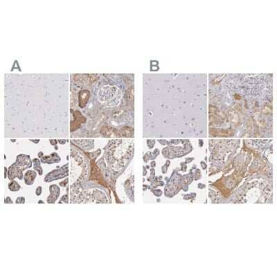 Immunohistochemistry-Paraffin: Serpin A1/alpha 1-Antitrypsin Antibody [NBP1-90309]