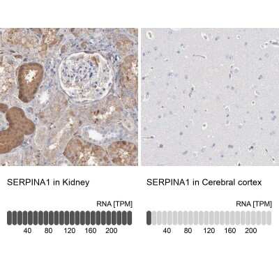 Immunohistochemistry-Paraffin: Serpin A1/alpha 1-Antitrypsin Antibody [NBP1-90309]