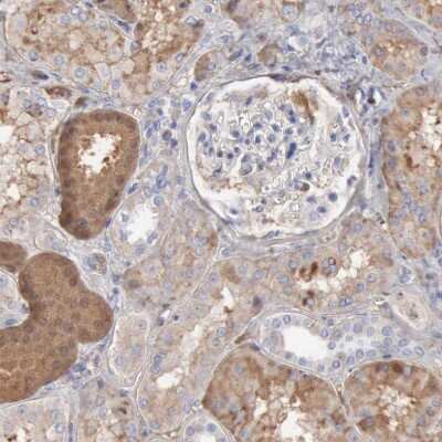 Immunohistochemistry-Paraffin: Serpin A1/alpha 1-Antitrypsin Antibody [NBP1-90309]