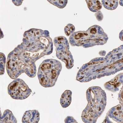 Immunohistochemistry-Paraffin: Serpin A1/alpha 1-Antitrypsin Antibody [NBP1-90309]