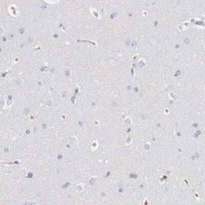 Immunohistochemistry-Paraffin: Serpin A1/alpha 1-Antitrypsin Antibody [NBP1-90309]