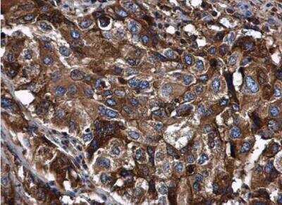 Immunohistochemistry-Paraffin: Serpin A1/alpha 1-Antitrypsin Antibody [NBP2-15349]