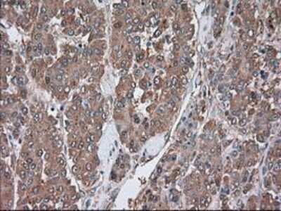 Immunohistochemistry: Serpin A1/alpha 1-Antitrypsin Antibody (OTI9A1) - Azide and BSA Free [NBP2-74095]