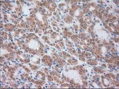 Immunohistochemistry: Serpin A1/alpha 1-Antitrypsin Antibody (OTI9A1) - Azide and BSA Free [NBP2-74095]