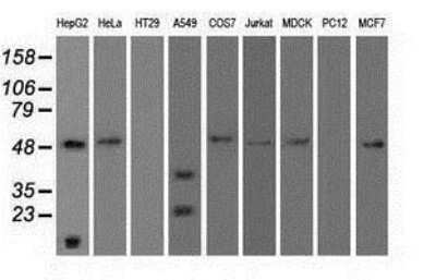 Western Blot: Serpin A1/alpha 1-Antitrypsin Antibody (OTI9A1)Azide and BSA Free [NBP2-74095]