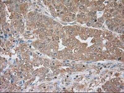 Immunohistochemistry-Paraffin: Serpin A1/alpha 1-Antitrypsin Antibody (OTI9A1) [NBP1-47957]
