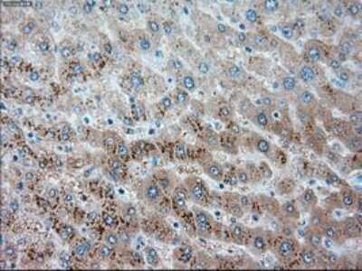 Immunohistochemistry-Paraffin: Serpin A1/alpha 1-Antitrypsin Antibody (OTI9A1) [NBP1-47957]