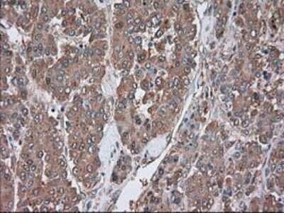 Immunohistochemistry-Paraffin: Serpin A1/alpha 1-Antitrypsin Antibody (OTI9A1) [NBP1-47957]