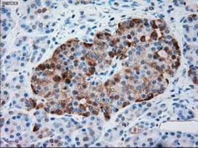 Immunohistochemistry-Paraffin: Serpin A1/alpha 1-Antitrypsin Antibody (OTI9A1) [NBP1-47957]