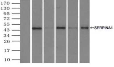 Immunoprecipitation: Serpin A1/alpha 1-Antitrypsin Antibody (OTI9A1) [NBP1-47957]