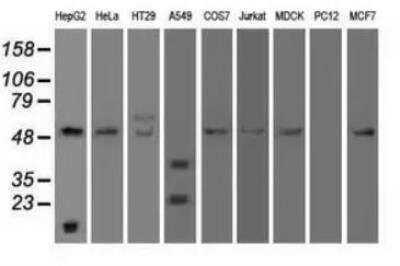 Western Blot: Serpin A1/alpha 1-Antitrypsin Antibody (OTI9A1) [NBP1-47957]