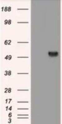 Western Blot: Serpin A1/alpha 1-Antitrypsin Antibody (OTI9A1) [NBP1-47957]
