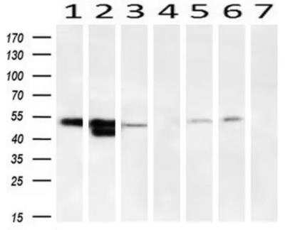 Western Blot: Serpin A1/alpha 1-Antitrypsin Antibody (OTI9A1) [NBP1-47957]