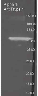 Western Blot: Serpin A1/alpha 1-Antitrypsin Antibody [NB600-602]