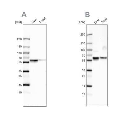 Western Blot: Serpin A1/alpha 1-Antitrypsin Antibody [NBP1-90308]