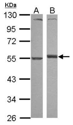 Western Blot: Serpin A1/alpha 1-Antitrypsin Antibody [NBP2-15349]