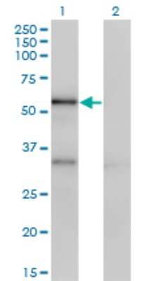 Western Blot: Serpin A10/ZPI Antibody (1E11) [H00051156-M02]