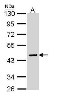 Western Blot: Serpin A10/ZPI Antibody [NBP1-32903]