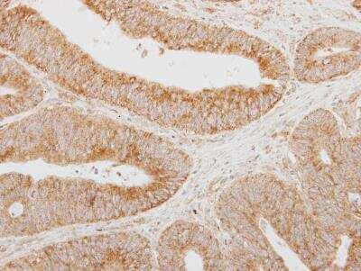 Immunohistochemistry-Paraffin: Serpin A12 Antibody [NBP2-15118]