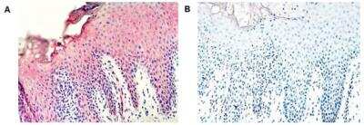 Immunohistochemistry: Serpin A12 Antibody (VP63) - Azide and BSA Free [NBP2-80041]