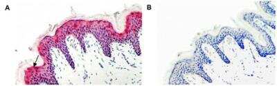 Immunohistochemistry: Serpin A12 Antibody (VP63) - Azide and BSA Free [NBP2-80041]
