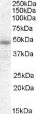 Western Blot: Serpin A12 Antibody [NBP1-20972]