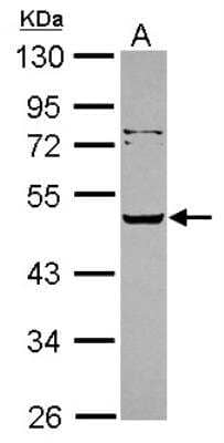 Western Blot: Serpin A12 Antibody [NBP2-15118]