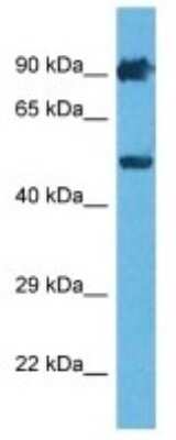 Western Blot: Serpin A12 Antibody [NBP3-10133]