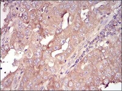 Immunohistochemistry-Paraffin: Serpin A3/alpha 1-Antichymotrypsin Antibody (5G3C11) - BSA Free [NBP2-52559]