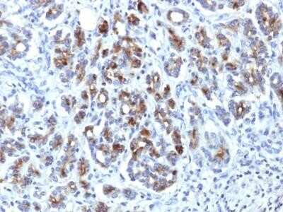 Immunohistochemistry-Paraffin: Serpin A3/alpha 1-Antichymotrypsin Antibody (AACT/1451) - Azide and BSA Free [NBP2-54339]