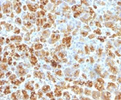 Immunohistochemistry-Paraffin: Serpin A3/alpha 1-Antichymotrypsin Antibody (AACT/1451) - Azide and BSA Free [NBP2-54339]