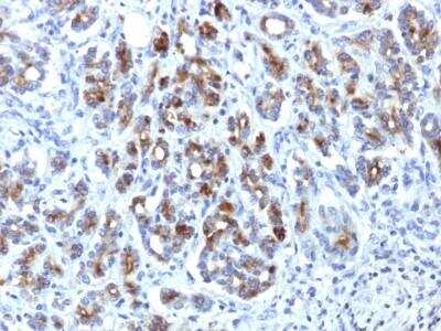 Immunohistochemistry-Paraffin: Serpin A3/alpha 1-Antichymotrypsin Antibody (AACT/1451) [NBP2-53316]