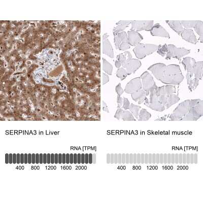 Immunohistochemistry-Paraffin: Serpin A3/alpha 1-Antichymotrypsin Antibody (CL10697) [NBP3-07987]