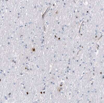 Immunohistochemistry-Paraffin: Serpin A3/alpha 1-Antichymotrypsin Antibody (CL10697) [NBP3-07987]