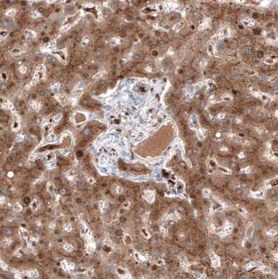 Immunohistochemistry-Paraffin: Serpin A3/alpha 1-Antichymotrypsin Antibody (CL10697) [NBP3-07987]