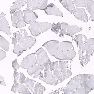 Immunohistochemistry-Paraffin: Serpin A3/alpha 1-Antichymotrypsin Antibody (CL10697) [NBP3-07987]