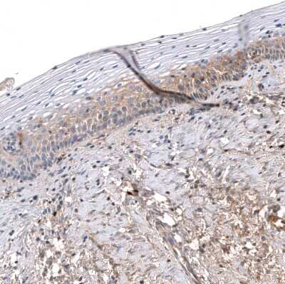 Immunohistochemistry-Paraffin: Serpin A3/alpha 1-Antichymotrypsin Antibody (CL10697) [NBP3-07987]